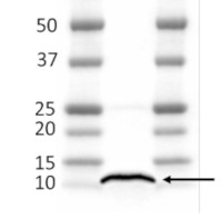PsaG | PSI-G subunit of photosystem I in the group Antibodies Plant/Algal / Photosynthesis / PSI (Photosystem I) at Agrisera AB (Antibodies for research) (AS20 4368)